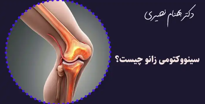 سینووکتومی زانو چیست؟