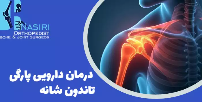 درمان دارویی پارگی تاندون شانه