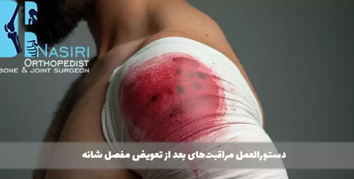 دستورالعمل مراقبت‌های بعد از تعویض مفصل شانه
