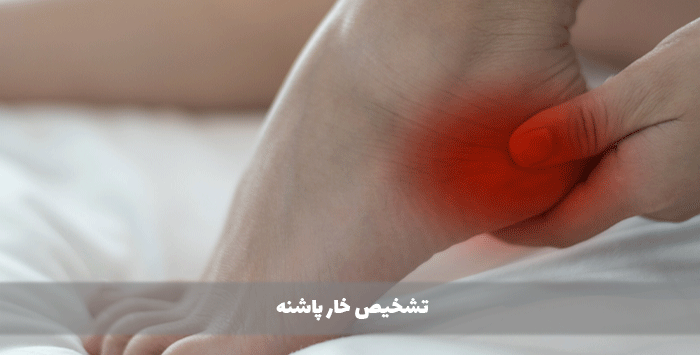 تشخیص خار پاشنه