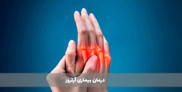 درمان بیماری آرتروز