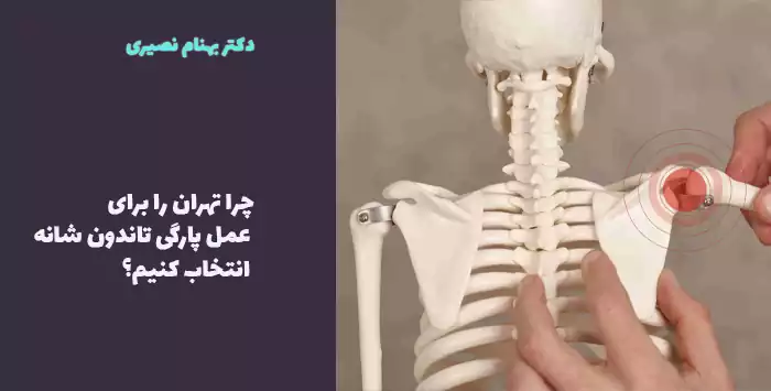 چه عواملی بر هزینه جراحی پارگی تاندون شانه در تهران تأثیر میگذارد؟