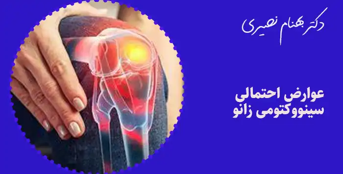 عوارض احتمالی سینووکتومی زانو