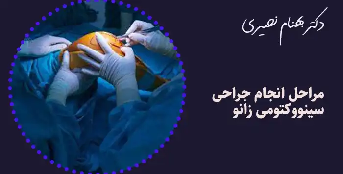 مراحل انجام جراحی سینووکتومی زانو