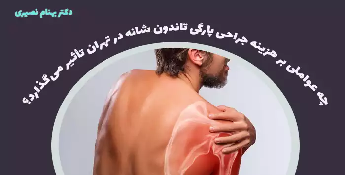 چه عواملی بر هزینه جراحی پارگی تاندون شانه در تهران تأثیر می‌گذارد؟