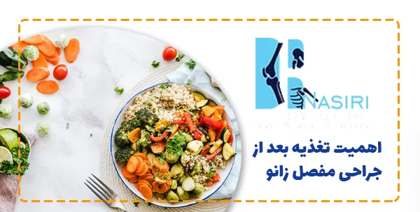 اهمیت تغذیه بعد از جراحی مفصل زانو