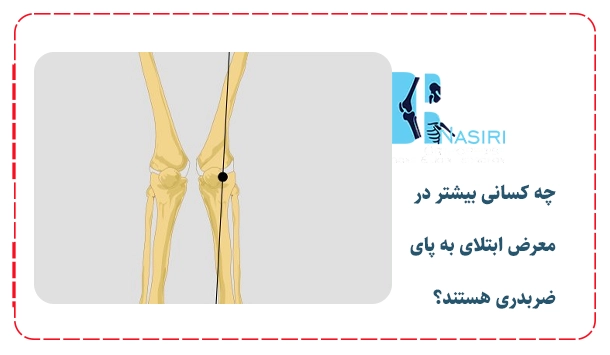 چه کسانی بیشتر در معرض ابتلای به پای ضربدری هستند؟