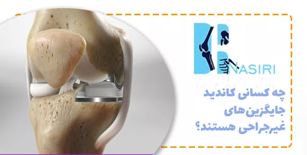 چه کسانی کاندید جایگزین‌های غیرجراحی هستند؟