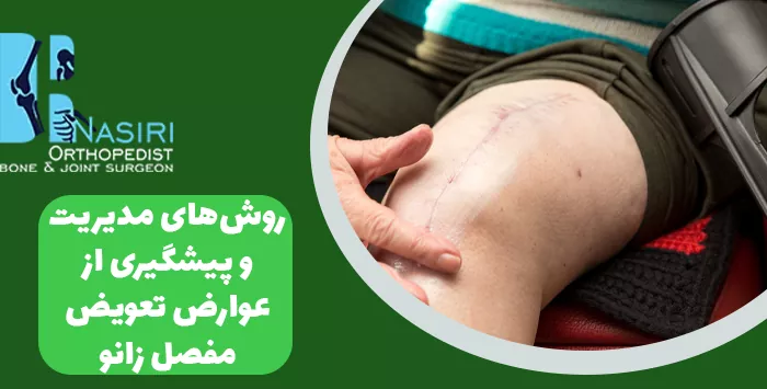 روش‌های مدیریت و پیشگیری از عوارض تعویض مفصل زانو