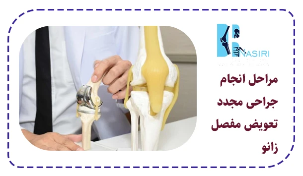 مراحل انجام جراحی مجدد تعویض مفصل زانو