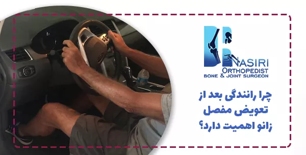 چرا رانندگی بعد از تعویض مفصل زانو اهمیت دارد؟